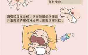 新生儿出生2天细菌感染