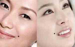 法令纹有痣的女人