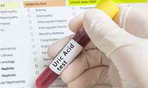 尿酸高有哪些症状不能吃什么水果