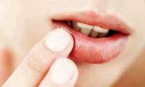 女性嘴唇上长水泡是什么原因