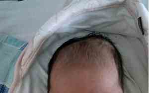 宝宝出生头长长的